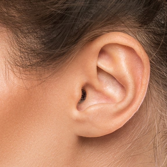 Prominent Ear Correction