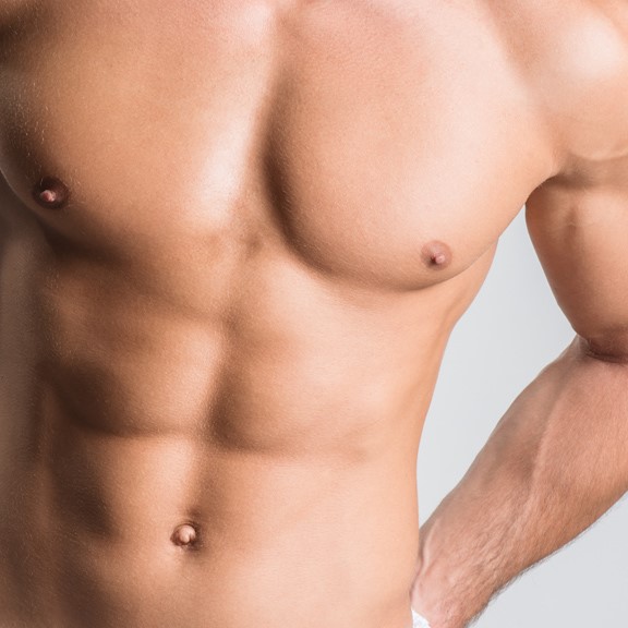 Male Breast Reduction