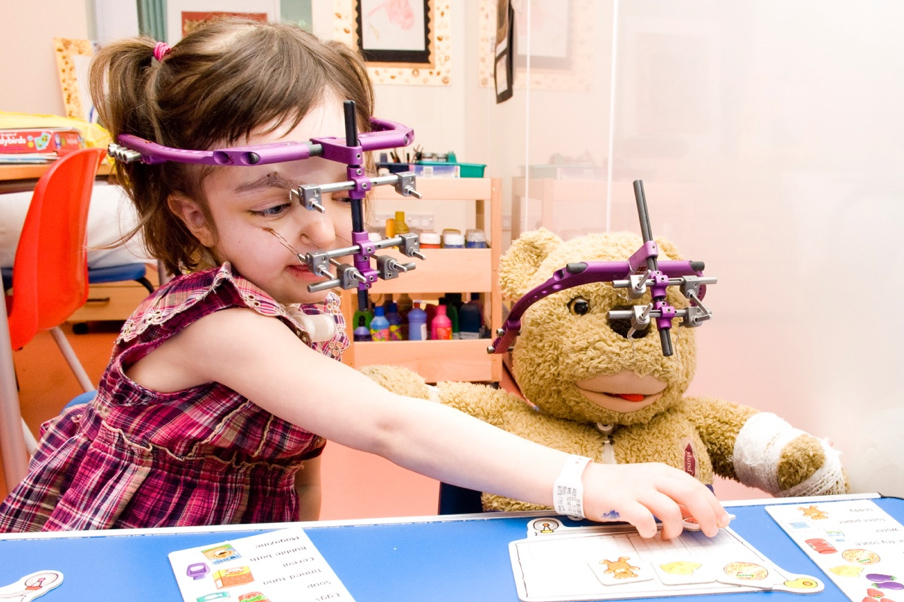 Syndromic Craniosynostosis