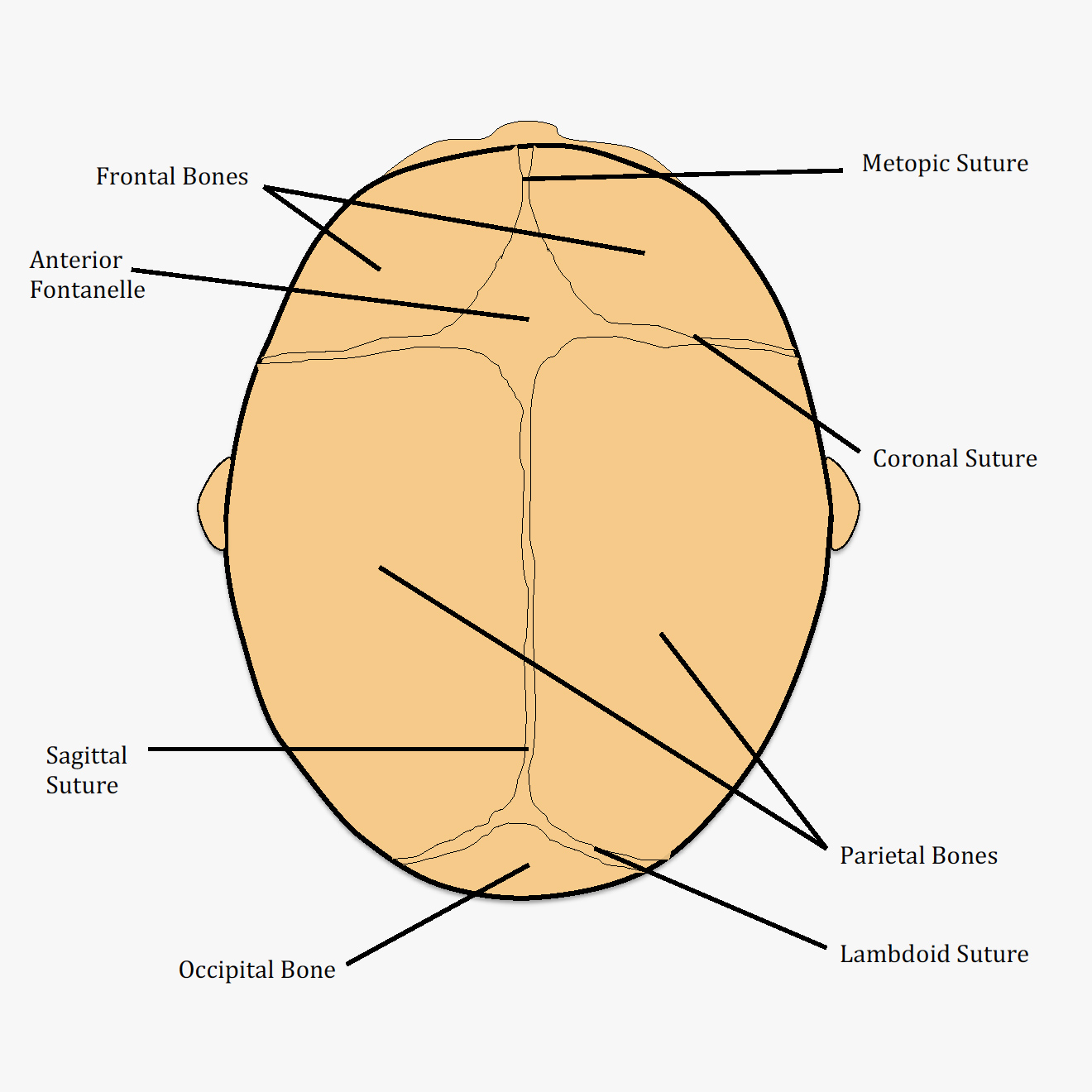 Craniosynotosis Surgery